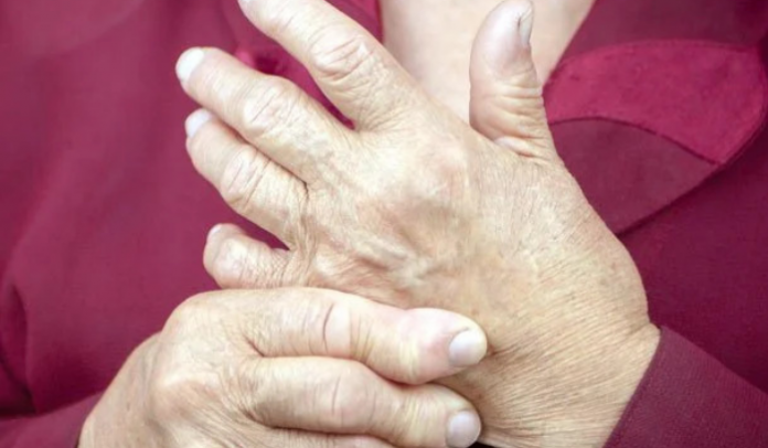 Rheumatoid arthritis drug could help treat covid-19